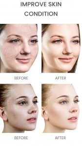 5D Hyaluronic acid hydrating face serum 10 5D Hyaluronic acid hydrating face serum 10
