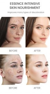 Rosehip& Niacinamide spots fading face serum 9 Rosehip& Niacinamide spots fading face serum 9