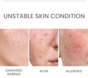 Ceramide B5 repairing face serum 3 Ceramide B5 repairing face serum 3