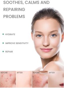 Ceramide B5 repairing face serum 7 Ceramide B5 repairing face serum 7